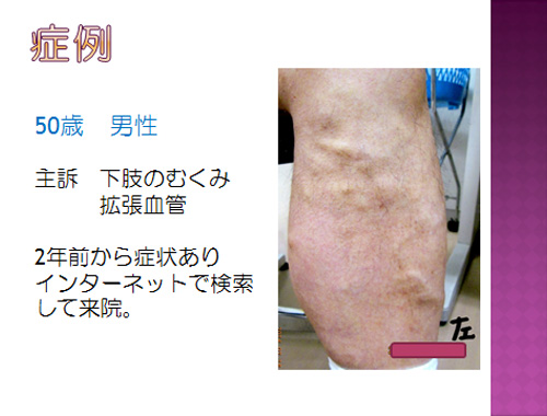 症例 50歳 男性