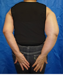 術前の写真